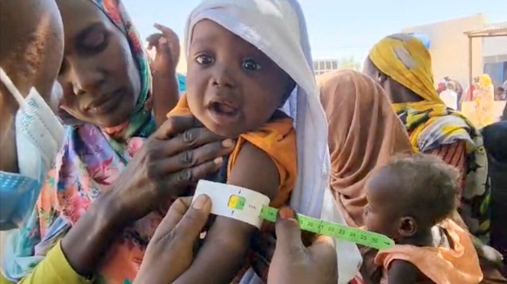 SUDAN DISPLACED EL-FASHER | Angelus en Español Un niño es sometido a pruebas de desnutrición en un campamento del Programa Mundial de Alimentos en El Fasher, Darfur (Sudán), el 27 de marzo de 2025, en esta captura de pantalla obtenida de un vídeo. (Foto de OSV News/WFP Handout vía Reuters)