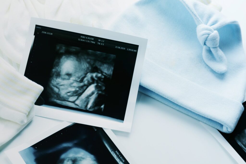 3d4dUltrasoundFilmShowBabyBoyInWomb6Month | Angelus en Español (Shutterstock)
